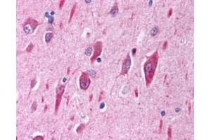 ABIN334459 (2. (PIK3CA antibody  (Internal Region))