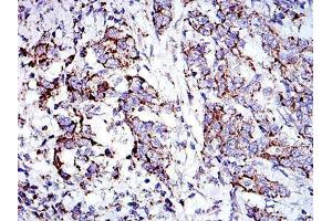 Immunohistochemistry (IHC) image for anti-Prohibitin (PHB) antibody (ABIN969353)