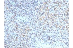 Formalin-fixed, paraffin-embedded human Spleen stained with CD40 Ligand Mouse Monoclonal Antibody (CD40LG/2763). (CD40 Ligand antibody  (AA 108-261))