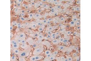 IHC-P analysis of liver tissue, with DAB staining.