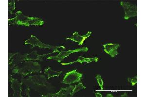 Immunofluorescence of monoclonal antibody to SH2D3C on HeLa cell. (SH2D3C antibody  (AA 1-703))