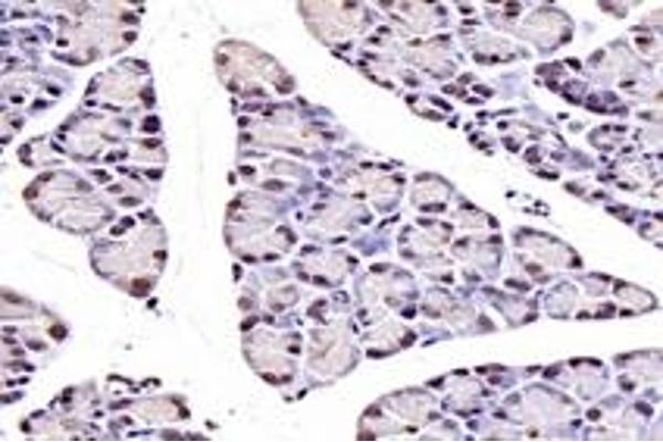 NUDT22 antibody