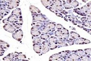 Immunohistochemistry analysis of paraffin-embedded rat pancreas using,NUDT22 (ABIN7074928) at dilution of 1: 7200