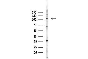 Western blot analysis of lysates from PC12 cells(LPS, 4h treatment), using RBM15 Antibody at 1/1000 dilution.