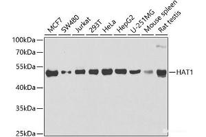 Western blot analysis of extracts of various cell lines using HAT1 Polyclonal Antibody at dilution of 1:1000. (HAT1 antibody)