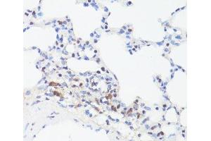 Immunohistochemistry of paraffin-embedded Rat lung using Phospho-MYC(S62) Polyclonal Antibody at dilution of 1:100 (40x lens). (c-MYC antibody  (pSer62))