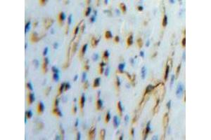 Used in DAB staining on fromalin fixed paraffin-embedded Heart tissue (TFPI antibody  (AA 29-306))