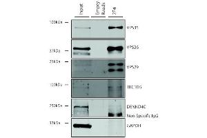 Immunoprecipitation analysis using Mouse Anti-VPS35 Monoclonal Antibody, Clone 7E4 (ABIN6932926). (VPS35 antibody  (FITC))