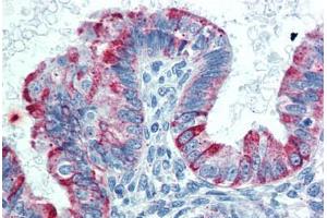 Immunohistochemistry (Formalin-fixed Paraffin-embedded Sections) (IHC (fp)) image for anti-Tumor Necrosis Factor Receptor Superfamily, Member 14 (TNFRSF14) (AA 38-284) antibody (ABIN790628)