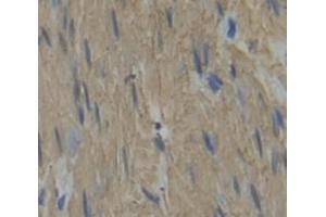 Figure. (MYH3 antibody  (AA 1403-1645))