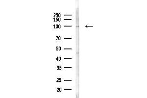 Western blot analysis of lysates from COLO205 cells(heat-shock,45 min treatment), using Drebrin Antibody at 1/1000 dilution.