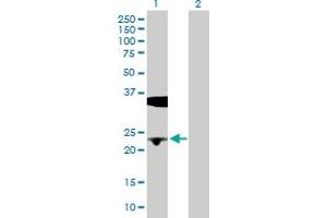 Western Blot analysis of BLVRB expression in transfected 293T cell line by BLVRB MaxPab polyclonal antibody. (BLVRB antibody  (AA 1-206))