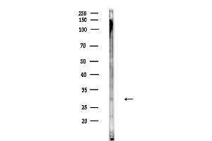 anti-Myelin Protein Zero-Like 2 (MPZL2) (Internal Region) antibody