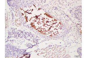 Formalin-fixed and paraffin embedded mouse embryo bone labeled with Anti-Bone Sialoprotein Polyclonal Antibody, Unconjugated (ABIN1386318) at 1:200 followed by conjugation to the secondary antibody and DAB staining (Bone Sialoprotein1/ 2 (AA 241-317) antibody)