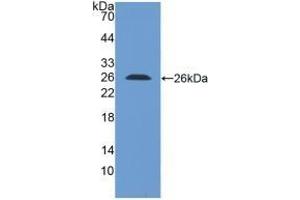 Detection of Recombinant LILRB1, Human using Polyclonal Antibody to Leukocyte Immunoglobulin Like Receptor Subfamily B, Member 1 (LILRB1) (LILRB1 antibody  (AA 223-410))