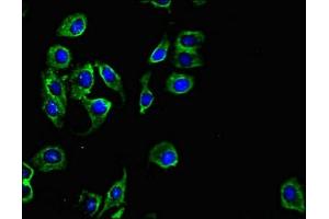 Immunofluorescent analysis of A549 cells using ABIN7163828 at dilution of 1:100 and Alexa Fluor 488-congugated AffiniPure Goat Anti-Rabbit IgG(H+L) (PKD1L3 antibody  (AA 22-194))