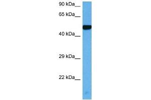 Host:  Rabbit  Target Name:  MYC  Sample Tissue:  Mouse Heart  Antibody Dilution:  1ug/ml (c-MYC antibody  (C-Term))