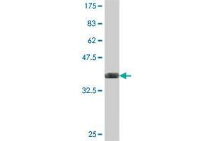 Western Blot detection against Immunogen (37. (NRIP1 antibody  (AA 1051-1158))