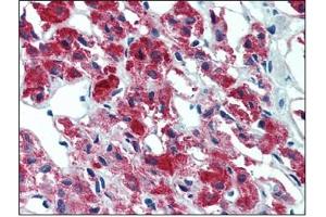 Immunohistochemistry (IHC) image for anti-Interleukin 23, alpha subunit p19 (IL23A) antibody (ABIN614363) (IL23A antibody)