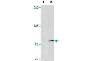Western blot analysis of EPHA4 (arrow) using EPHA4 polyclonal antibody . (EPH Receptor A4 antibody  (AA 40-70))