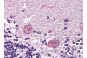 Image no. 1 for anti-Protein Phosphatase 2, Regulatory Subunit B'', alpha (PPP2R3A) (Internal Region) antibody (ABIN372864) (PPP2R3A antibody  (Internal Region))