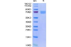 Human IL-22R alpha 1&IL-10R beta on Tris-Bis PAGE under reduced condition. (IL-22R alpha 1 & IL-10R beta (AA 16-228) protein (Fc-Avi Tag))