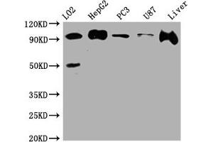 Western Blot Positive WB detected in: L02 whole cell lysate, HepG2 whole cell lysate, PC-3 whole cell lysate, U-87 whole cell lysate, Rat Liver whole cell lysate All lanes: ALIX antibody at 1:1000 Secondary Goat polyclonal to rabbit IgG at 1/50000 dilution Predicted band size: 97, 97, 31 kDa Observed band size: 97 kDa