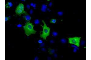 Image no. 7 for anti-Acetyl-CoA Acetyltransferase 2 (ACAT2) antibody (ABIN1496401) (ACAT2 antibody)