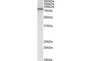 Western Blotting (WB) image for anti-Acyl-CoA Synthetase Long-Chain Family Member 4 (ACSL4) (C-Term) antibody (ABIN2465674)