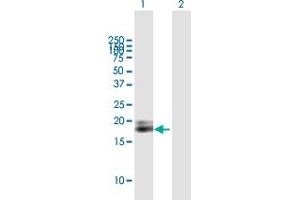 Western Blot analysis of IFNA1 expression in transfected 293T cell line by IFNA1 MaxPab polyclonal antibody. (IFNA1 antibody  (AA 1-189))