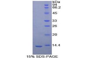 SDS-PAGE (SDS) image for FK506 Binding Protein 1B, 12.6 KDa (FKBP1B) (AA 2-108) protein (His tag) (ABIN1079573) (FKBP1B Protein (AA 2-108) (His tag))
