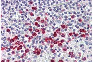 Human Spleen, Macrophages (formalin-fixed, paraffin-embedded) stained with MMP9 antibody ABIN337099 at 5 ug/ml followed by biotinylated anti-mouse IgG secondary antibody ABIN481714, alkaline phosphatase-streptavidin and chromogen. (MMP 9 antibody)
