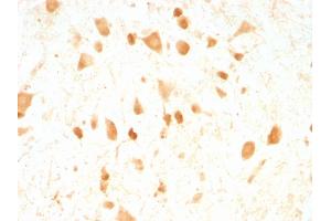 Formalin-fixed, paraffin-embedded Rat Cerebellum stained with Pgp9. (UCHL1 antibody)