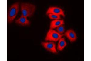 Immunofluorescent analysis of Tyrosine Hydroxylase staining in DLD cells. (Tyrosine Hydroxylase antibody  (N-Term))