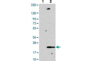 Western blot analysis of Lane 1: Negative control (vector only transfected HEK293T lysate).