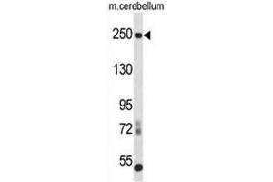 Western blot analysis in mouse cerebellum tissue lysates (35ug/lane) using CD171 / L1CAM Antibody .