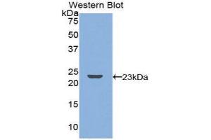 Western Blotting (WB) image for anti-Tumor Necrosis Factor Receptor Superfamily, Member 11a, NFKB Activator (TNFRSF11A) (AA 359-542) antibody (ABIN3205542) (TNFRSF11A antibody  (AA 359-542))
