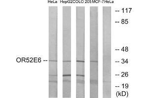 Western blot analysis of extracts from HeLa cells, HepG2 cells, COLO cells and MCF-7 cells, using OR52E6 antibody.