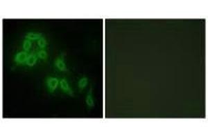 Immunofluorescence analysis of HepG2 cells, using Collagen V α2 antibody. (COL5A2 antibody)