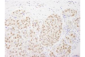 anti-RNA polymerase-associated protein RTF1 homolog (RTF1) (C-Term) antibody
