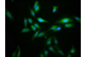 Immunofluorescence staining of Hela cells with ABIN7165598 at 1:166, counter-stained with DAPI. (FLII antibody  (AA 577-729))