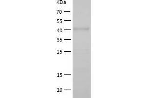 Western Blotting (WB) image for Transcriptional Adaptor 3 (TADA3) (AA 1-432) protein (His tag) (ABIN7284612) (TADA3L Protein (AA 1-432) (His tag))