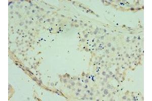 Immunohistochemistry of paraffin-embedded human testis tissue using ABIN7170477 at dilution of 1:100 (SPAG16 antibody  (AA 1-183))