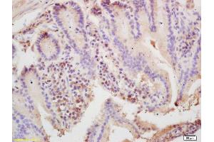 Formalin-fixed and paraffin embedded mouse intestine labeled with Rabbit Anti ARP3 Polyclonal Antibody, Unconjugated (ABIN1387419) at 1:200 followed by conjugation to the secondary antibody and DAB staining (ANGPTL6 antibody  (AA 301-400))