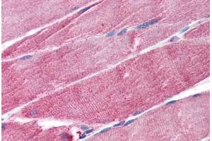 Human Skeletal Muscle (formalin-fixed, paraffin-embedded) stained with TRIM63 antibody ABIN297307 at 1. (TRIM63 antibody  (AA 247-261))