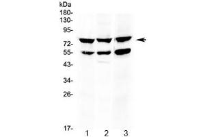 Western blot testing of 1) rat thymus, 2) mouse thymus and 3) human HepG2 lysate with RANK antibody at 0.