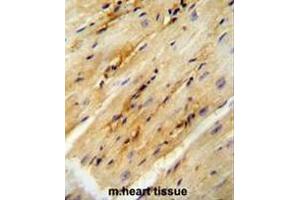 GPD1L antibody (N-term) immunohistochemistry analysis in formalin fixed and paraffin embedded mouse heart tissue followed by peroxidase conjugation of the secondary antibody and DAB staining. (GPD1L antibody  (N-Term))
