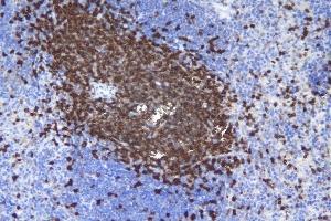 IHC analysis of CD5 using anti-CD5 antibody (ABIN7600839).