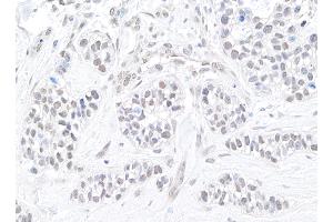 anti-Tripartite Motif Containing 24 (TRIM24) (AA 700-750) antibody