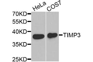 Western blot analysis of extracts of HeLa and COS7 cells, using TIMP3 antibody. (TIMP3 antibody)